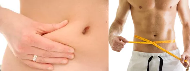 Fettabsaugung am Bauch bei einer Frau in der Schönheitsklinik Berlin